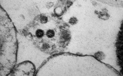 Медики назвали необычный симптом омикрон-штамма коронавируса